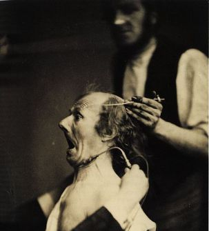 Illustration for article titled The quest for the perfect smile required electrocuting people's faces